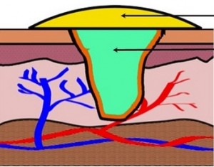 VETI-GEL